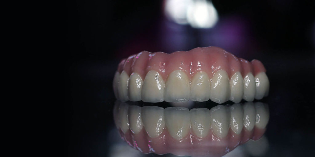 zirconia fixed bridge