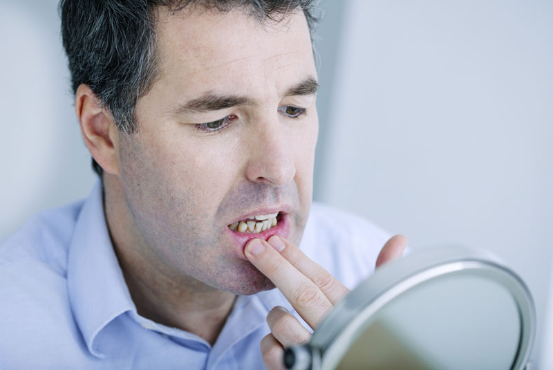 man checking teeth