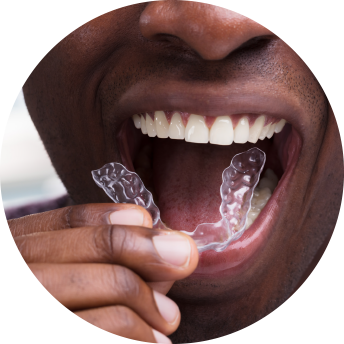 man putting on Invisalign